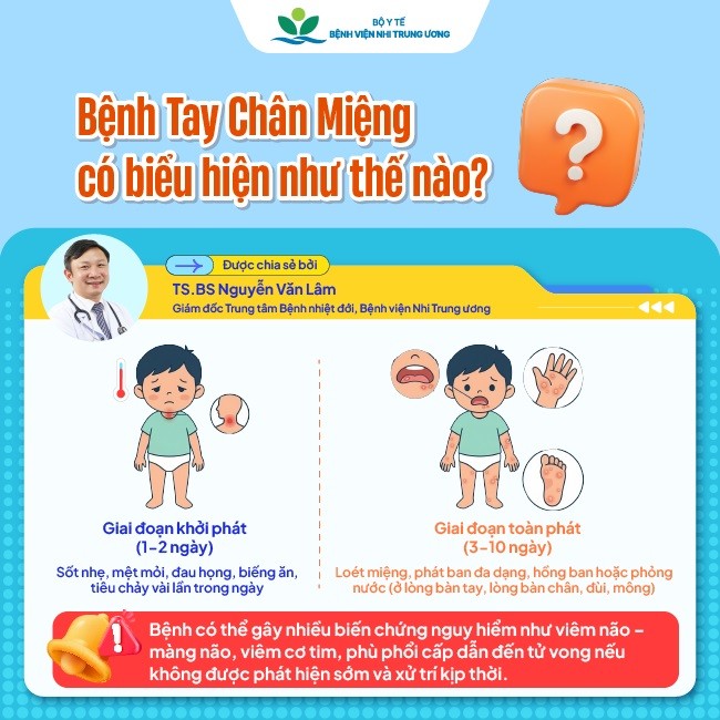 Từ đầu năm 2026 đến nay có gần 3.000 trẻ được chẩn đoán mắc tay chân miệng