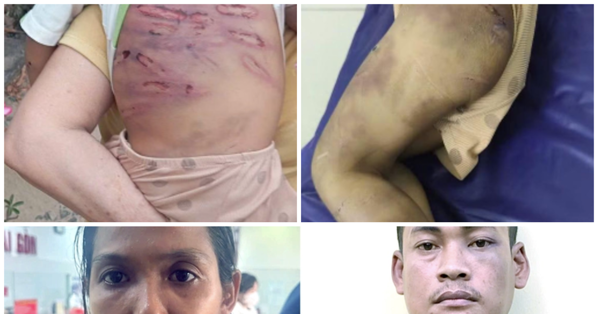 Bắt giữ khẩn cấp người phụ nữ cùng nhân tình hành hạ dã man bé trai 2 tuổi