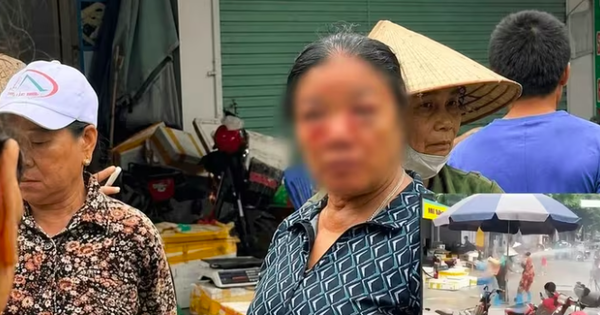 Công an xác minh việc người phụ nữ bán rau bị thương do nước xịt vào mắt gây xôn xao dư luận ở phú Thọ