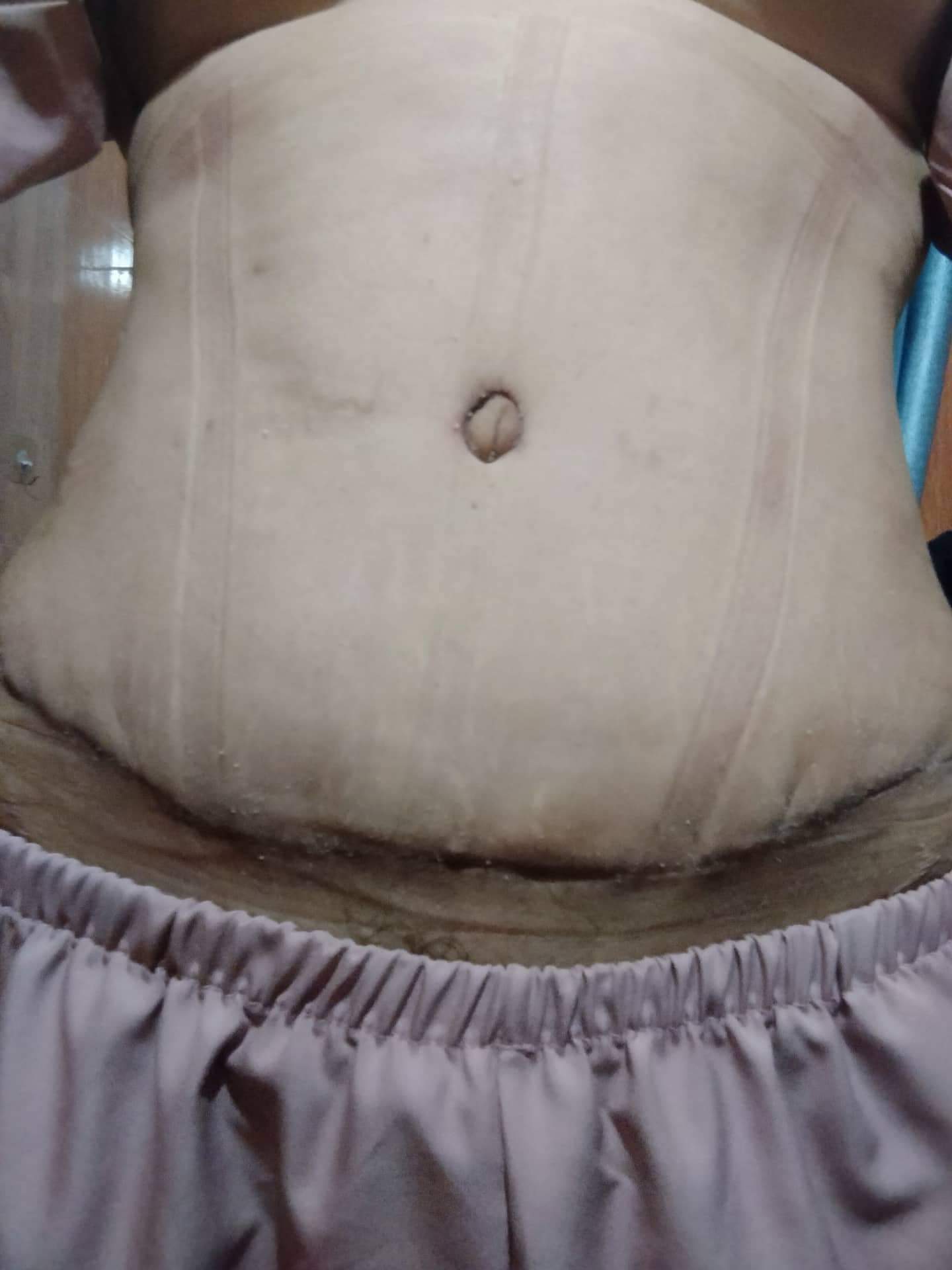 Hình ảnh sau khi phẫu thuật thẩm mỹ tại trung tâm TM DrD. Ảnh: nhân vật cung cấp