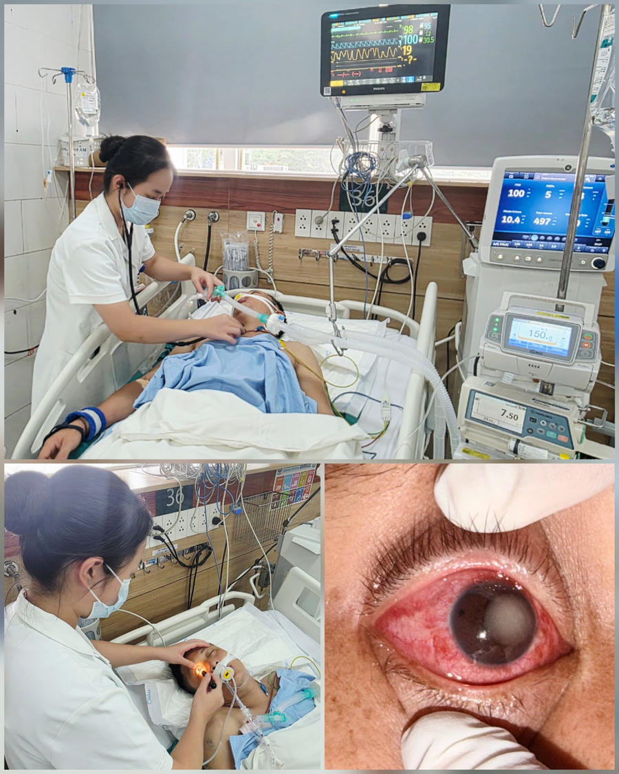 Nam người bệnh 37 tuổi bị bỏng giác mạc sau khi tiếp xúc với khí clo. (Ảnh: Bệnh viện Bạch Mai)