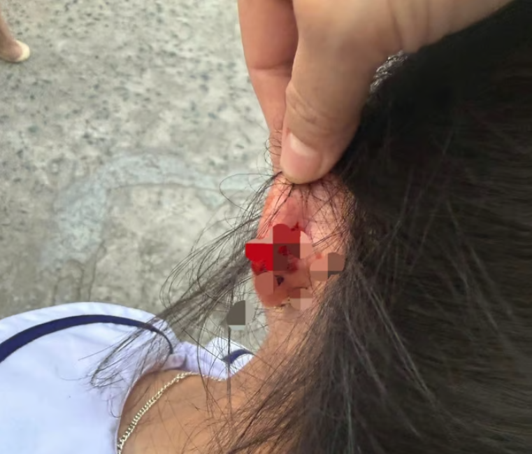 Phú Quốc: Xem xét kỷ luật giáo viên lớp 1 bị tố nhéo tai học sinh đến chảy máu Phú Quốc: Xem xét kỷ luật giáo viên lớp 1 bị tố nhéo tai học sinh đến chảy máu